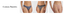 Briefs